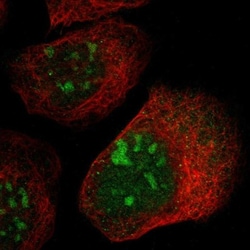 P-Selectin/CD62P Antibody, Novus Biologicals:Antibodies:Primary Antibodies